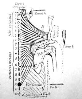 Esquema bidimensional de moreaux